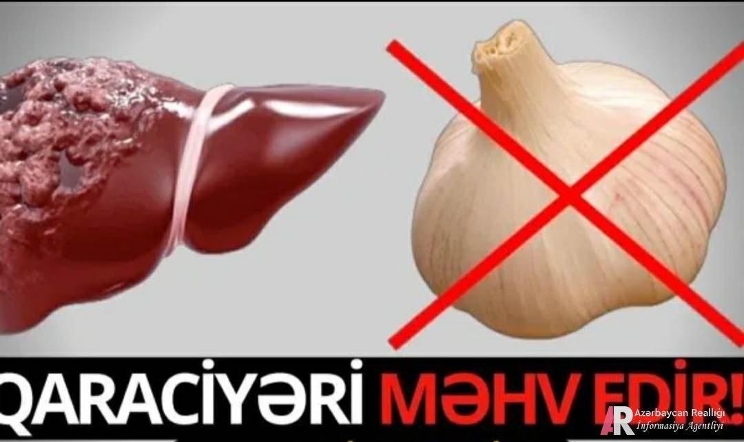 Sarımsaq qaraciyəri məhv edir - SENSASİON İDDİA