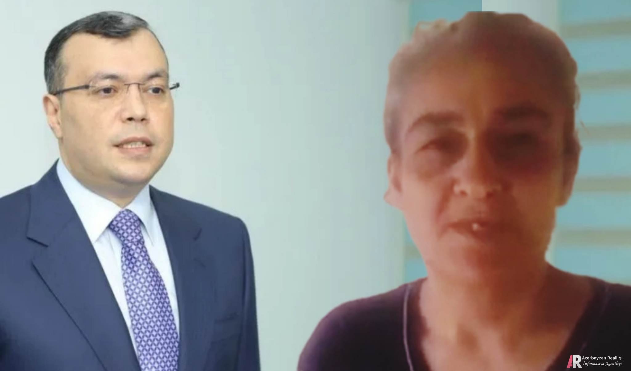 Sahil Babayevin daha bir QURBANI: Epilepsiya xəstəsinin pensiyasını kəsdi - Bərpa etməyə pul istəyirlər (VİDEO)
